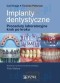 Implanty dentystyczne. Procedury laboratoryjne